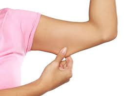 Lifting des bras Tunisie: chirurgie esthétique des bras