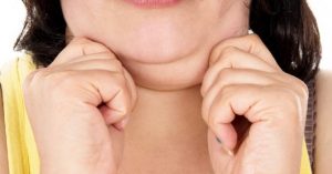 traitement double menton kybella