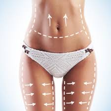 La liposuccion : avis et conseils